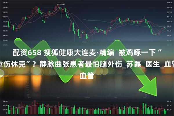 配资658 搜狐健康大连麦·精编  被鸡啄一下“重伤休克”？静脉曲张患者最怕腿外伤_苏磊_医生_血管